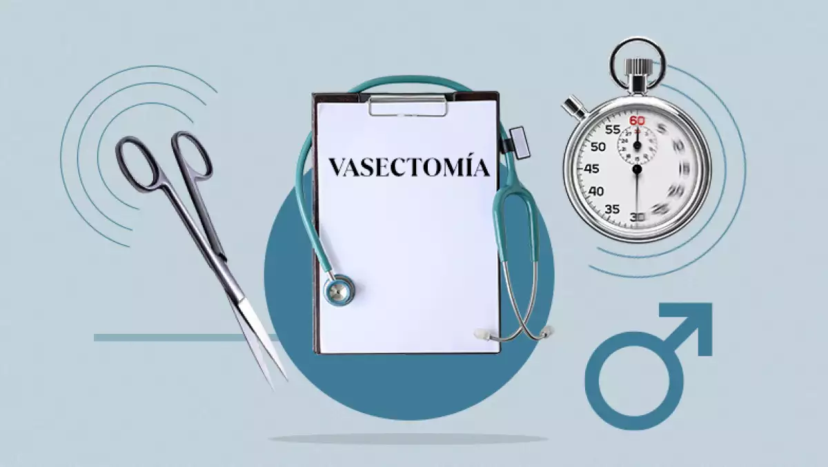 vasectomia